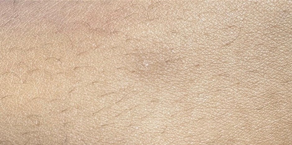 Leg scar · faded flat — after using Glowtivated